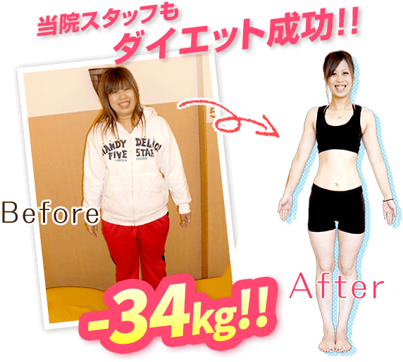 当院スタッフも-34kgダイエットに成功